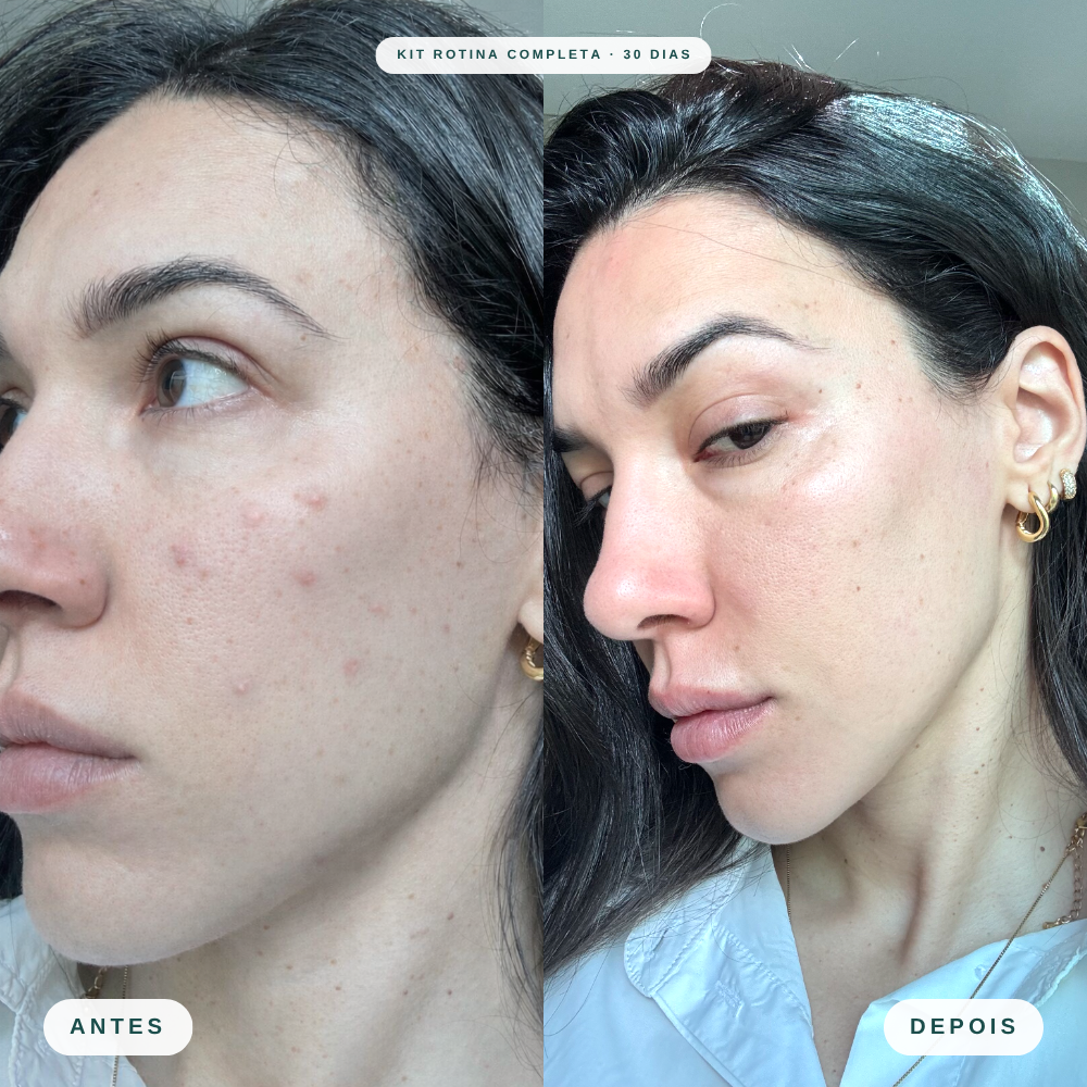 Skincare Kit Rotina Completa - Mizz