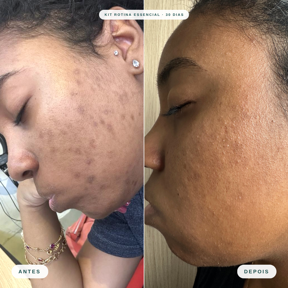 Skincare Kit Rotina Essencial - Mizz
