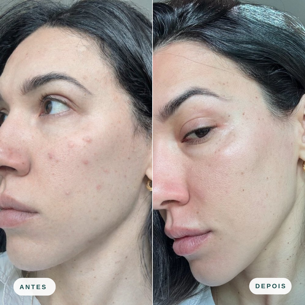 Espuma Facial de Limpeza  - Mizz
