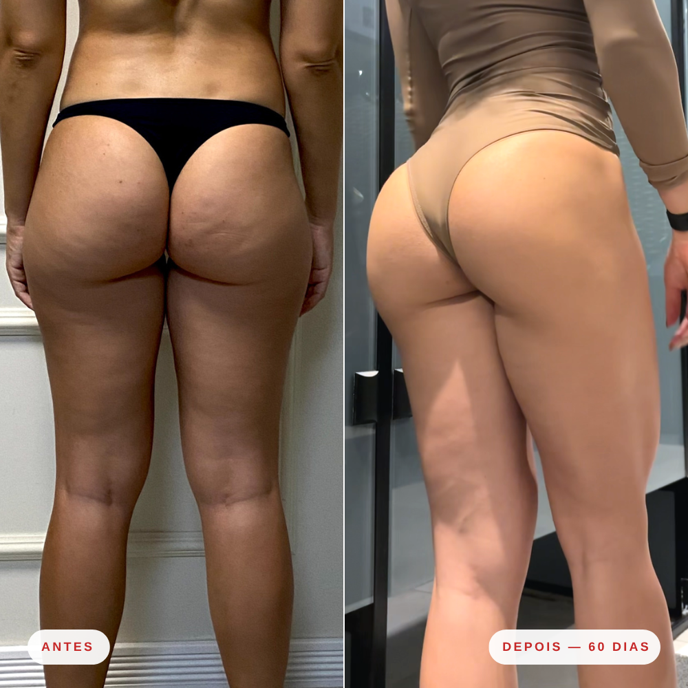 Espuma Corporal Thermo Skin - Mizz