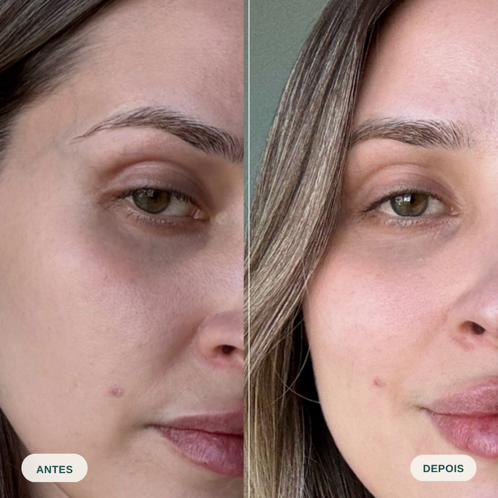 Sérum Lifting Olhos Anti Bolsas e Olheiras - Mizz