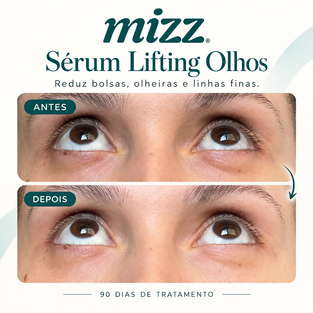 Antes e depois Sérum Lifting Olhos Mizz após 90 dias — redução de bolsas, olheiras e linhas finas na área