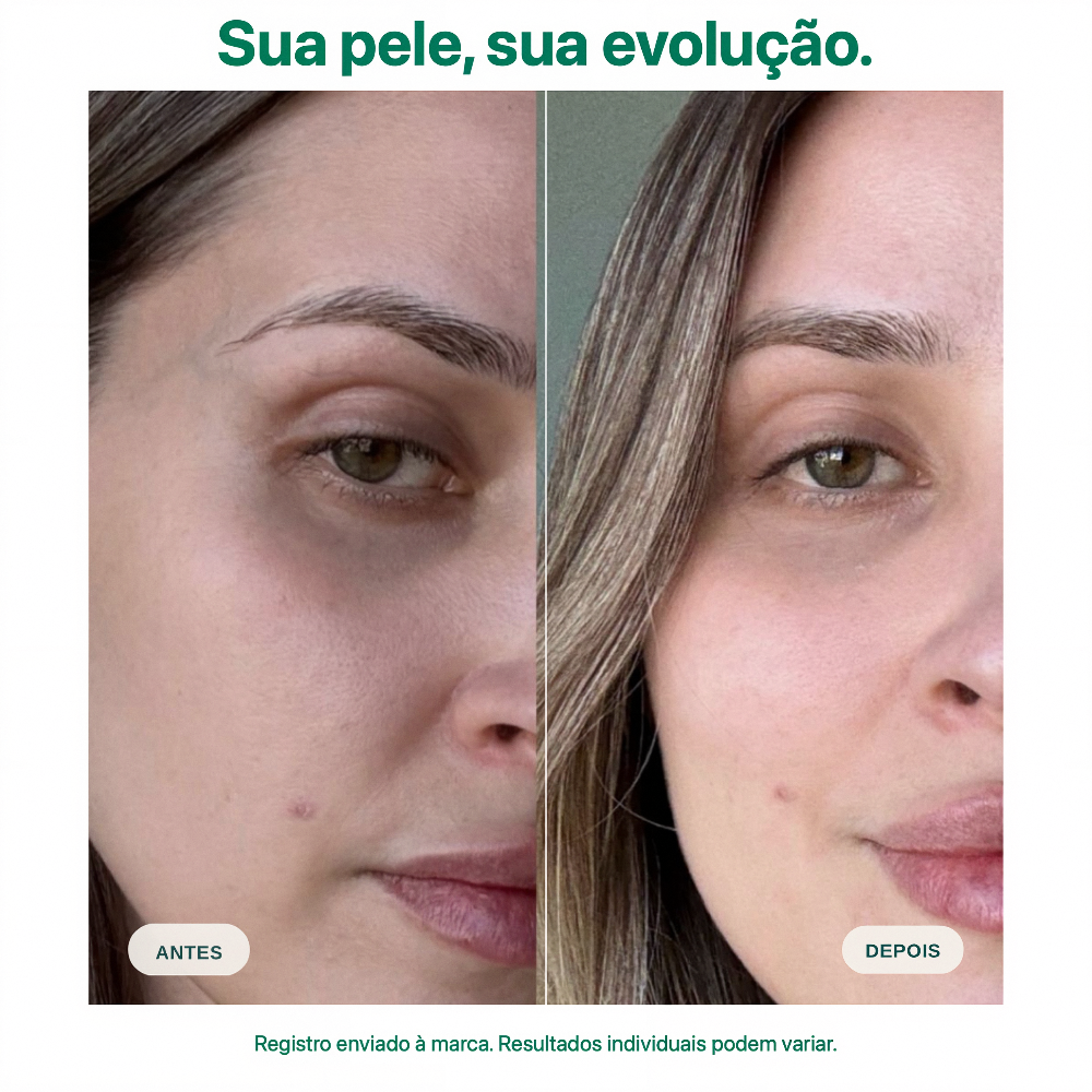 Antes e depois Sérum Lifting Olhos Mizz: redução visível de olheiras, bolsas e iluminação na área dos olhos