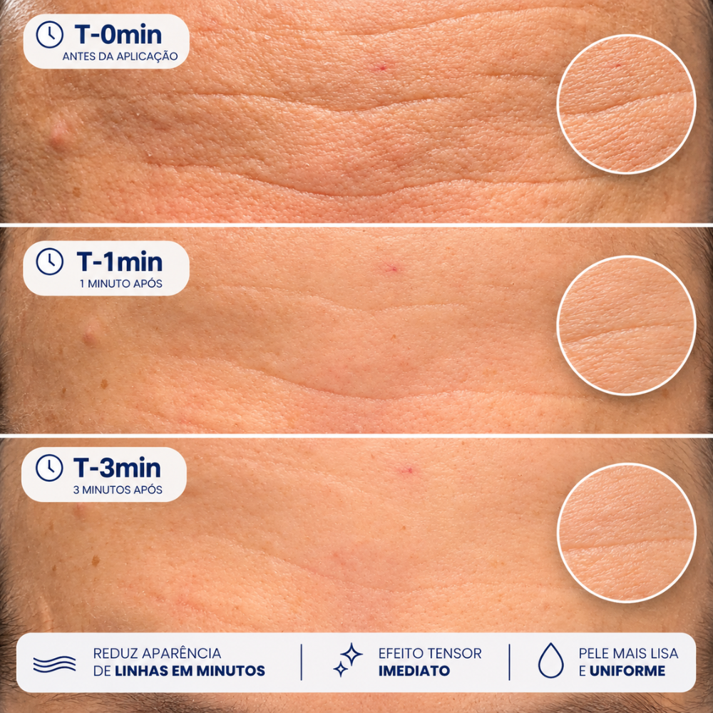 Pep Botulin Mizz — redução visível de linhas em minutos. Testes T-0, T-1min, T-3min comprovam efeito tensor